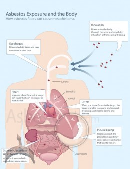 Mesothelioma Law Firm