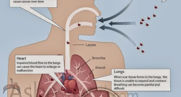 Mesothelioma Law Firm Knowing what National Mesothelioma Law Firm is