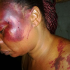 battered woman