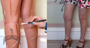 Leg contouring