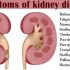 Clean Your Kidney Now, Avoid Dialysis